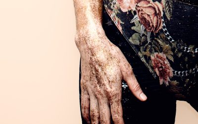 Vitiligo: Causas e Manifestações